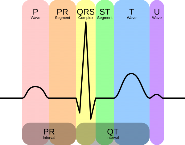 EKG