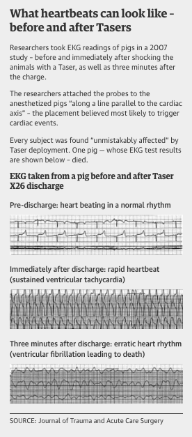 What Does a Taser do to your body?