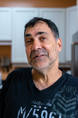 David Tuller poses for a photograph without his partial dentures. Tuller says during his period of intense dental care, he hated wearing temporaries and often braved the public with missing front teeth. (Heidi de Marco/KHN)